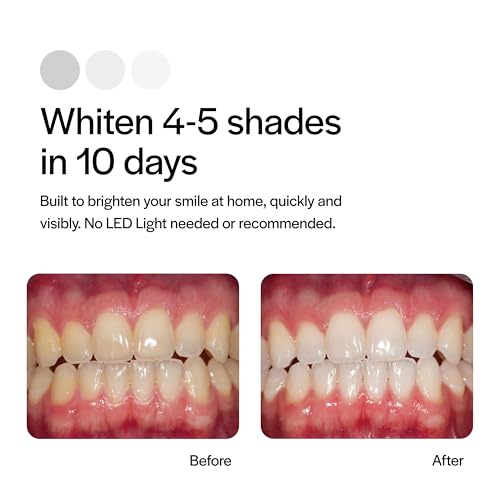 Opalescence Go 15 PF - Prefilled Teeth Whitening Trays - (10 Treatments) Hydrogen Peroxide 15 and Potassium Fluoride - Made by Ultradent - GO15-PF-4638