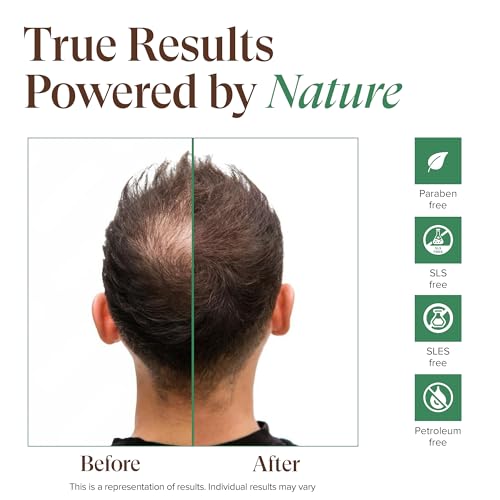 Kreyol Essence - Scalp Care POMAD, Detox + Treat, Rosemary Peppermint 4 Oz, Natural, Paraben Free, Healthy Scalp, Hair Care