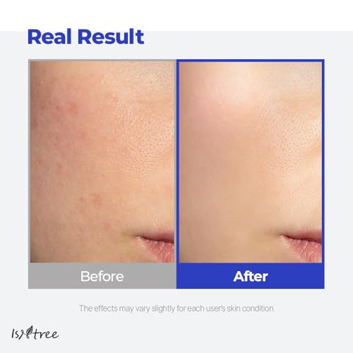 IsNtree Hyaluronic Acid Aqua Gel Cream 100ml, 3.38 fl oz | Korean Skincare | Lightweight Moisturizer | Quick-Absorbing Hydration | For Oily to Combination Skin