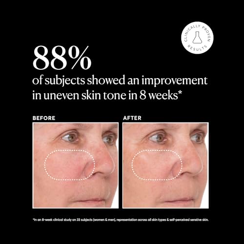 Naturium Vitamin C Super Serum Plus, Smoothing Face Care, plus Retinol, Hyaluronic Acid, Niacinamide & Salicylic Acid, 1 oz