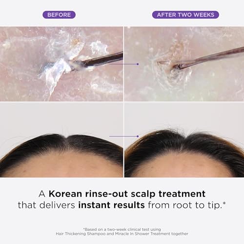 Dr. Groot Scalp Revitalizing Solution Scalp Happiness Set – LIMITED EDITION HOLIDAY SET