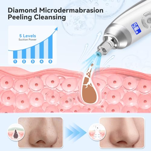 Upgraded Diamond Micro-Dermabrasion Facial Machine, Professional Facial Deep Cleasing Tool, Home Use Facial Skin Care Equipment