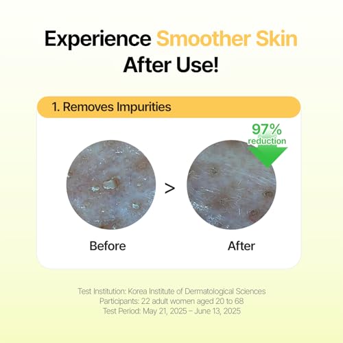 Green Tangerine Pore Tok-Tok Sheet Mask (3-in-1 Bio-Cellulose Gel) (Eosidin Care) – Pore Care, Sebum Control, Collagen Peel Off Facial Skincare for Deep Cleansing & Smooth Skin, 4 Sheets