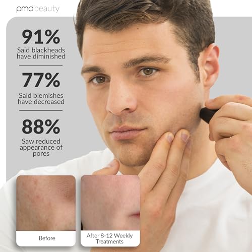 PMD Beauty Personal Microderm Man - At-Home Microdermabrasion Machine with Kit for Face & Body - Exfoliating Crystals and Vacuum Suction for Bold and Striking Skin