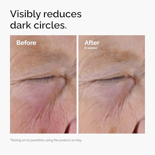 The Ordinary Caffeine Solution 5% + EGCG, Depuffing Eye Serum for Dark Circles and Tired Eyes