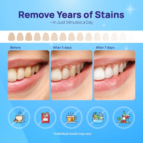 Whitebite Pro Upgraded Teeth Whitening Strips 28 Strips (14 Treatments) | Enamel-Safe | Deep Stains Removal | Non-Slip Design | Whitening Without Any Harm | Mint