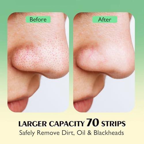 AUSLKA Blackhead Pore Strips,(70 Counts) Blackhead Remover-Deep Cleansing Nose Strips With Instant Pore Unclogging, Nose Plant Strips for Blackheads