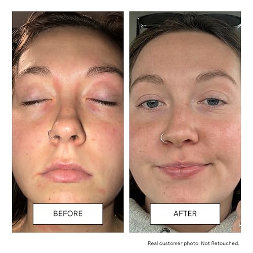 Untoxicated Face Wash - Gentle & Hydrating Face Cleanser for Sensitive Skin - Ceramides, Hyaluronic Acid & Glycerin - No Common Irritants - Non-Foaming - Soap Free - Fragrance Free - 7 Ounce