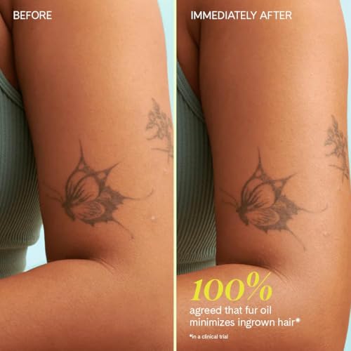 Ingrown Hair Oil for Bikini Line, Underarms, Legs & More – Soothes Razor Bumps, Prevents Ingrowns, Reduces Redness & Irritation – Jojoba, Clary Sage & Tea Tree – 14mL