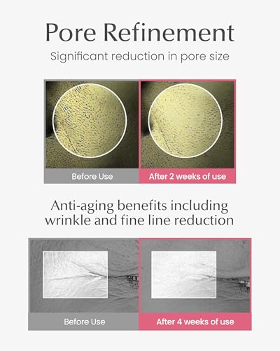 Derma Pore 4D Collagen Serum (1.69 fl. oz) Hydrating Peptide Serum for Minimizing the Appearance of Pores, Skin Firming & Radiant Skin, Makeup Prep, Korean Skincare