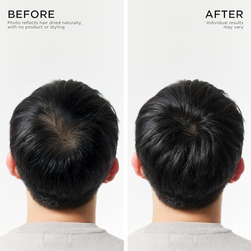 Dr. Groot Scalp Revitalizing Solution Scalp Happiness Set – LIMITED EDITION HOLIDAY SET