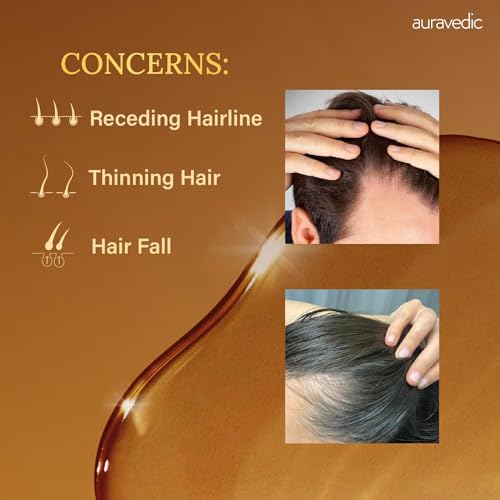 Auravedic Rosemary Hair Growth Oil with Moringa, Fenugreek & Brahmi | Scalp Nourishing Oil for Dry, Weak Hair & Breakage Care | Supports Fuller-Looking, Healthier Hair | 3.38 Fl Oz (100ml)