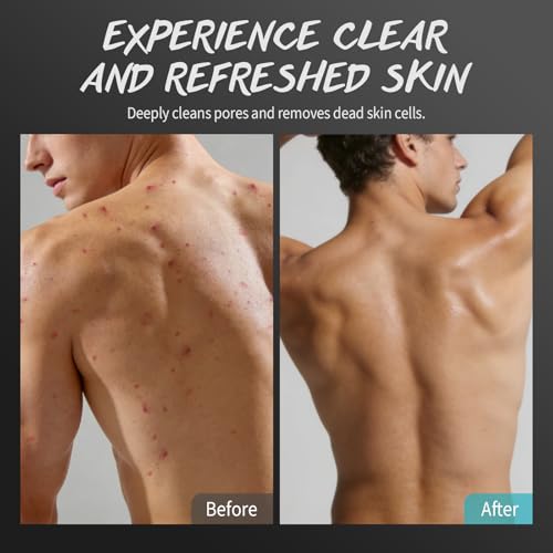 Men Body Scrub with Tea Tree Oil Exfoliating Body Scrub for Men Improve Odor Smooth Rough Skin Body Exfoliator Scrub for Back Chest Shoulders Butt Legs Mens Exfoliating Body Wash with 2% BHA 10% AHA