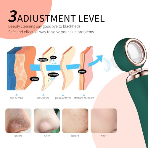 2025 Blackhead Remover Pore Vacuum, Visual Rechargeable Blackhead Vacuum Facial Pore Cleaner-3 Suction Soft Silicone,3 Probes,USB Kit Electric Acne Extractor Tool for Adult