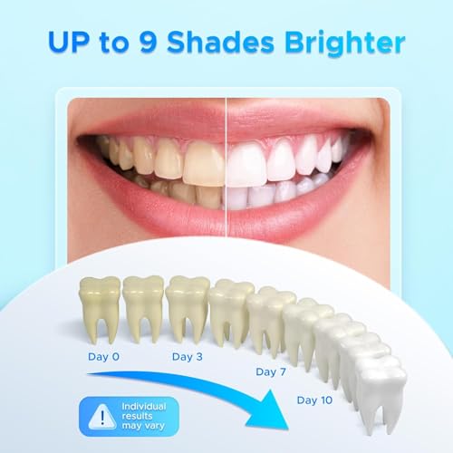 Luelli Teeth Whitening Pen, 50+ Uses - Travel Size Professional Tooth Whitener Gel, Extra Strength Organic Teeth Bleaching Gel for Sensitive Teeth, Instant Stain Removal, Simply White Smile, 4 Count