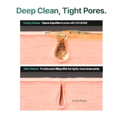 CELORABY Potension Pore Tightening Boost Serum - Advanced Korean Skincare Pore Minimizer with Exosome Technology, Targets Excess Sebum & Impurities (1.01 fl.oz)