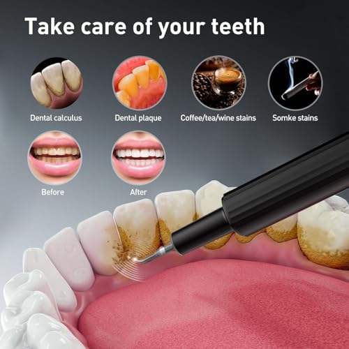 Plaque Remover for Teeth - Tartar Remover for Teeth, Dental Calculus Remover Teeth Cleaning Kit 4 Speed Modes with 4 Replaceable Heads, IPX6 Waterproof with LED Light