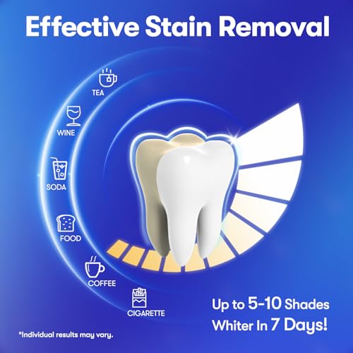 MySmile Teeth Whitening Strips, Hydroxyapatite-Infuse White Strips, Non-Sensitive Tooth Whitener with Soothing Natural Ingredients, Enamel-Safe, Residue-Free, Non-Slip (28 Count)