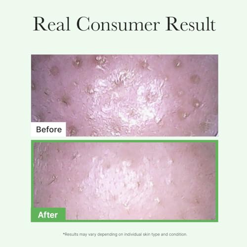 ARENCIA Pore Melt Mochi Makeup-Removing Cleansing Oil, Non-Comedogenic, Rice Amino Acids HD, Vitamin E, Cica, & Ceramide, 6.76 fl oz