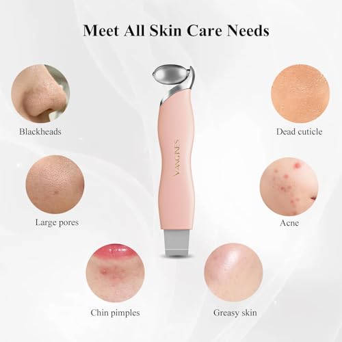 Blackhead Scraper Tool & Skin Scrubber Face Spatula for Blackhead Removal, Pore Cleaning, with Cooling Ice Roller & 2 Silicone Brush Heads (Dusty Rose)