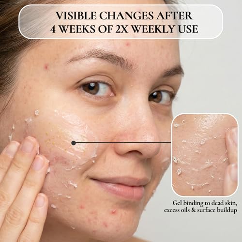 Vivo Per Lei Facial Peeling Gel - Helps Address Dead Skin Buildup - Gentle Exfoliating Gel for Rough, Dry, Sensitive or Mature Skin - Face and Body Scrub - Non Abrasive - 4.05 Fl. Oz.