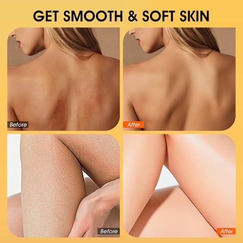 VOERUY Body Scrub, Turmeric Exfoliating Body Scrub, with Coconut Oil & Vitamin C, Bikini Area Exfoliator Gently Exfoliate Body Hand and Foot Scrub, Moisturized Skin for Women and Men, 11.28oz/320g