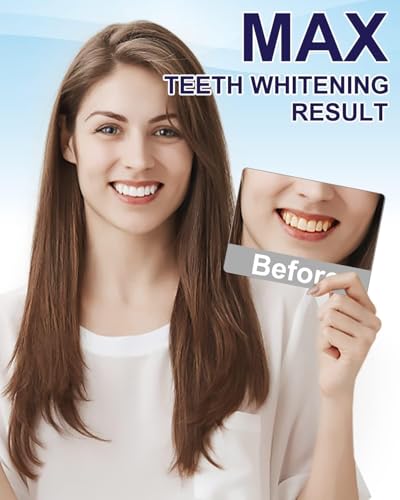 MySmile Teeth Whitening Pen 30+ Treatment Enamel Safe Tooth Whitening Gel for Teeth Sensitive-10 Min Fast Whitening Teeth-Helps to Remove Stains from Coffee, Smoking, Wines-Mint Flavor