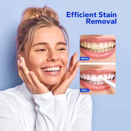 Premium Teeth Whitening Pens (4 Count), Sensitive-Free Whitening Gel, Professional-Strength Formula, On-The-Go Tooth Gel for Adults