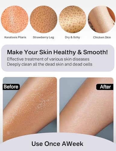 Yiclick Heavy Exfoliating Gloves 4Pcs, Exfoliating Mitts, Body Scrubber for Bath Shower Exfoliation, Body Scrub Exfoliator for Dead Skin Remover, Exfoliate Sponge Loofah Washcloth Men Women