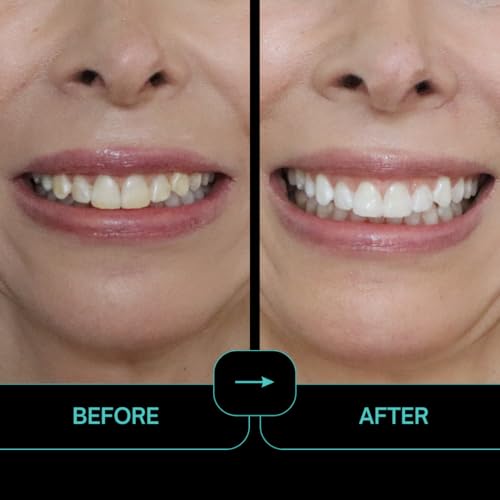 IntelliWHiTE ProStrips Teeth Whitening Strips, Whitens Up to 12 Shades, Enamel-Safe Gentle Remineralizing Formula, Dentist Formulated for Sensitive Teeth, (56pk Mint Flavor)