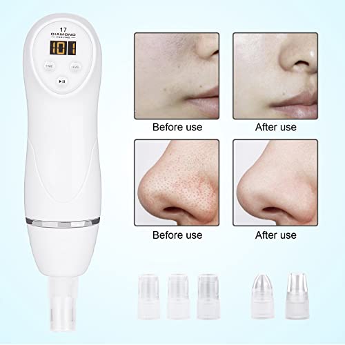 Diamond Microdermabrasion Machine Professional Blackhead Remover Vacuum Upgraded Facial Pore Cleaner Electric USB with 8 Probes Blackhead Remover Skincare Tool