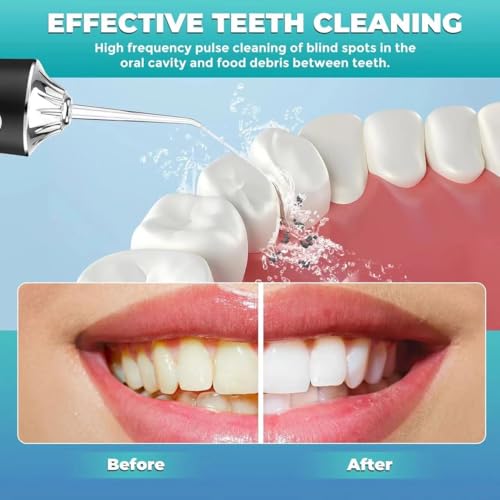 Water Dental Flosser Teeth Pick Portable Cordless Oral Irrigator Rechargeable Travel Irrigation Cleaner 3 Modes 4 Jets IPX7 Waterproof Electric (White)