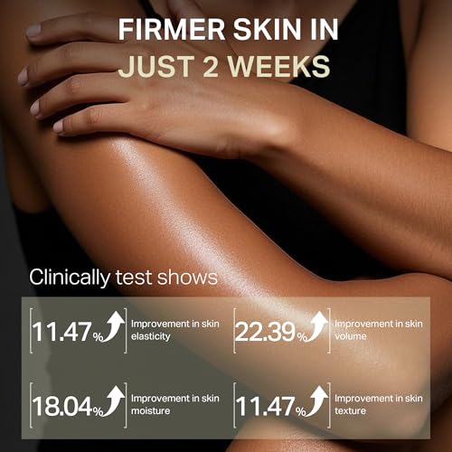 Ultra-Size Firming Retinol Body Lotion for Crepey Skin & Keratosis Pilaris with 0.05% Retinol, AHA, Collagen, Body Cream, Anti Aging Moisturizer 10.14 fl oz