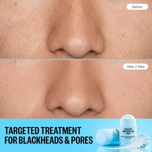 PEACE OUT Pore Perfecting Stick, Clay Cleanser for Pores and Blackheads, Exfoliating Face Stick with Glycolic and Salicylic Acid, Targets Oil and Texture, 0.53oz