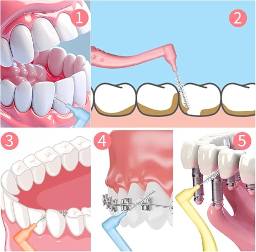 50pcs Interdental Brushes, 5 Sizes Braces Brush Set Soft Dental Brushes with Non-Slip Handle Angled Head Tooth Picks Floss Sticks Dental Floss Brushes for Braces Oral Cleaning