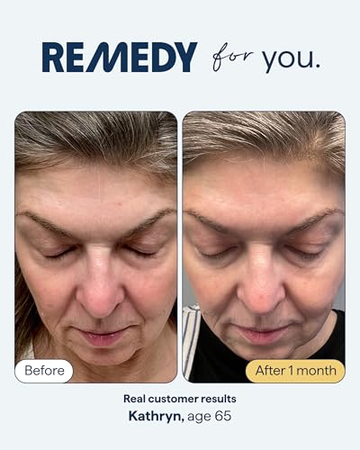 Remedy Healthy Aging Advanced Serum - Remedy for Healthy Aging - Retinaldehyde, Glycolic Acid, Argireline, Ferulic Acid,Matrixyl 3000 - Anti-Aging - For Fine Lines,Wrinkles - By Dermatologist Dr. Shah