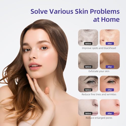 IeBilif Diamond Microdermabrasion Dermabrasion Machine Professional for Blackhead Removal, 3 in 1 Diamond Microdermabrasion Machine with Vacuum Spray, Home Use Facial Skin Care Dermabrasion Kit