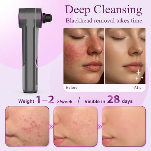 Blackhead Remover Vacuum, Pore Vacuum Blackhead Extractor, Pore Suction Face Suction, Electric 5 Heads Heating, Nose & Face Deep Clean, Pimple Sucker Remover Tools, USB Rechargeable 9 Modes 3 Levels