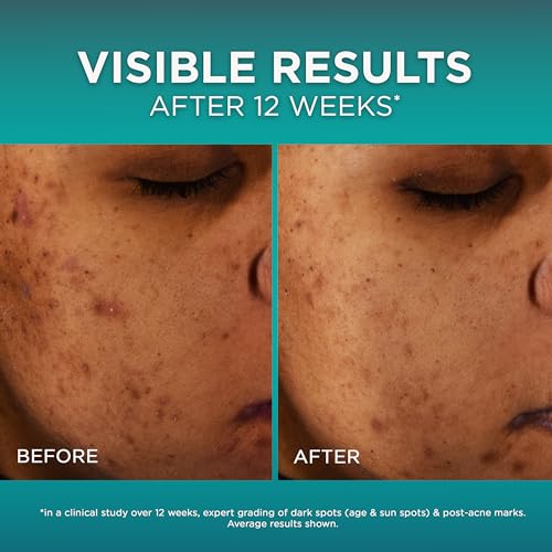 L’Oréal Paris Bright Reveal 12% [Niacinamide + Amino Sulfonic + Ferulic] Dark Spot Serum 1oz + Moisturizer Sample