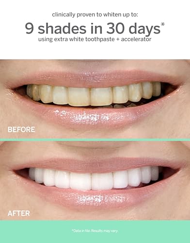 Supersmile Extra White Professional Whitening Accelerator - Enamel-Safe Teeth Whitening Gel - Effectively Lifts Deep-Set Stains Without Sensitivity - 7 oz