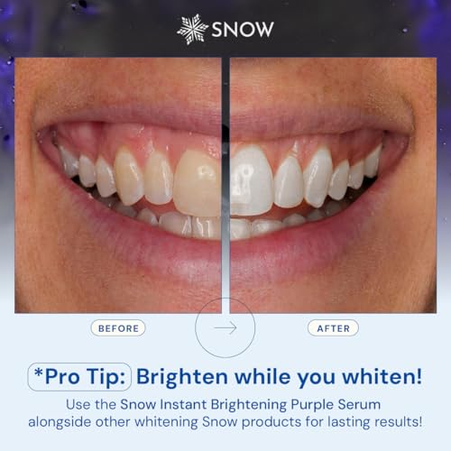 SNOW Teeth Brightening Purple Serum | Gentle & Enamel Safe Instant Brightening for Brighter Smile | Dental Care, Hygiene, & Tooth Care Bright Smile for Events Daily Confidence 2 Month Supply