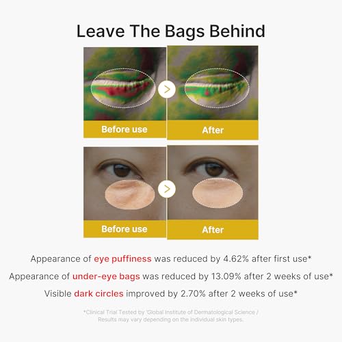 medicube Eye Serum with Kojic Acid Turmeric | All-Day Brightening Eye Gel Serum | Refreshing Eye Care with Vitamin C, Retinol & Caffeine | Hydrating & Cooling Formula | Korean Skincare, 1.01 fl.oz