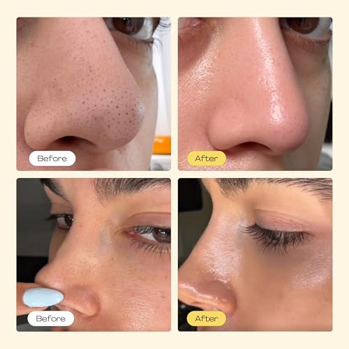 Pore Strips, Deep Cleansing Patch System, Blackhead Remover, Nose Plants Strips with 100 PCS, Blackhead Remover Peel off Mask Face & Nose