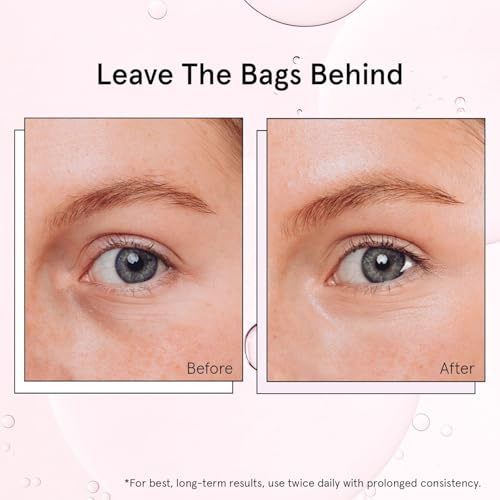 grace & stella Under Eye Brightener Roller - Airplane Travel Essentials - Travel Size Toiletries - Retinol & Caffeine Eye Serum for Puffiness, Dark Circles, Wrinkles - Vegan Skincare (15ml / 0.51floz)