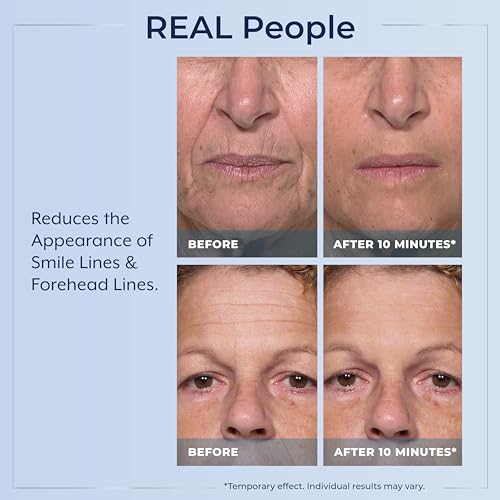 Plexaderm Rapid Reduction Eye Serum - Visibly Reduces Under-Eye Bags, Wrinkles, Dark Circles, Fine Lines & Crow's Feet Instantly, Anti Aging Wrinkle Remover for Face, Full Size Tube