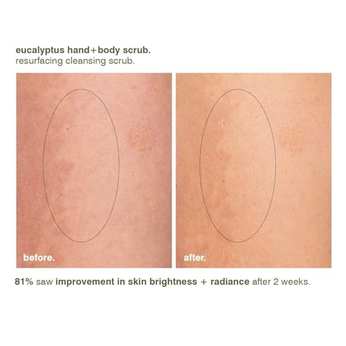 MALIN+GOETZ Eucalyptus Hand+Body Scrub | Resurfacing Cleanser Lactic Acid, Mandelic Acid, Pumice + Niacinamide | Deeply Cleanses, Smooths + Brightens | Vegan, Cruelty-Free, Paraben-Free (8.5 Fl Oz)