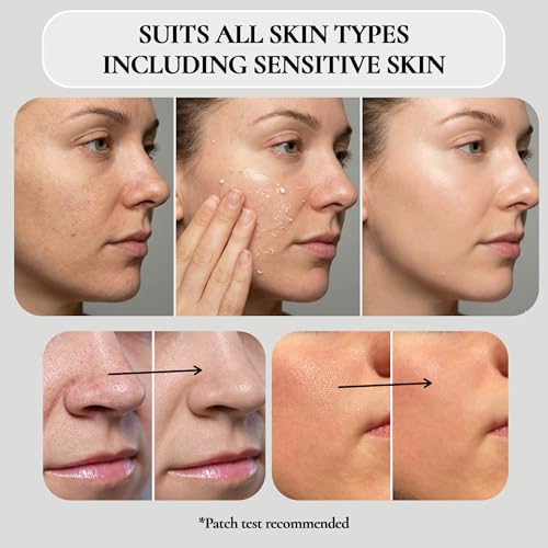 Vivo Per Lei Facial Peeling Gel - Helps Address Dead Skin Buildup - Gentle Exfoliating Gel for Rough, Dry, Sensitive or Mature Skin - Face and Body Scrub - Non Abrasive - 4.05 Fl. Oz.