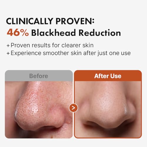 Hanskin BHA Pore Cleansing Oil, Gentle Blackhead Cleanser and Makeup Remover for Combination and Oily Skin, Korean Skincare [BHA/10.14 oz]