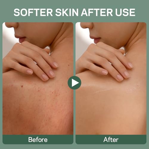 Exfoliating Body Scrub Soaps, 2 Pack Eucalyptus＋Charcoal Exfoliating Soap Bar for Men & Women - Smooth & Soften Skin, Detoxify, Body Exfoliator Bar with Dead Sea Sand