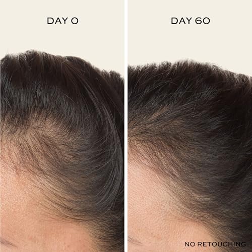 John Frieda ULTRAfiller+ Hair Density Scalp Serum for Fine Hair, Volumizing Hair Serum, Scalp Treatment for Thickening for Women and Men, 2 Oz